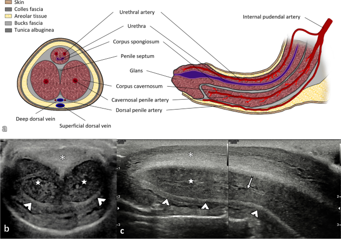 PENILE DOPPLER